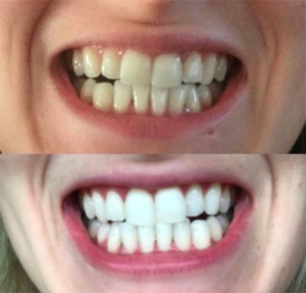 WhiteTeeth.ie €69