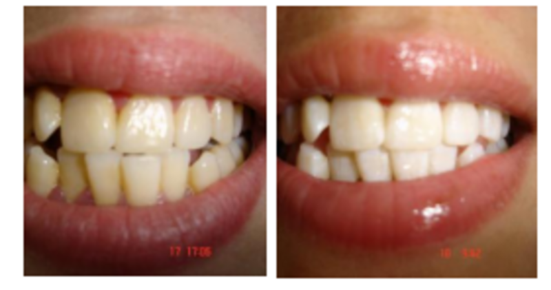 WhiteTeeth.ie €69