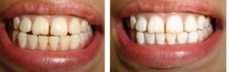 WhiteTeeth.ie €69