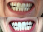 WhiteTeeth.ie €69